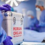 organ transplantation